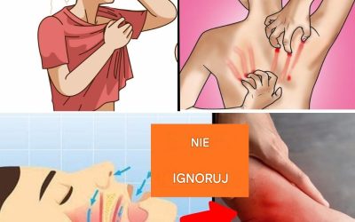 Ciche objawy anemii, których nigdy nie należy ignorować