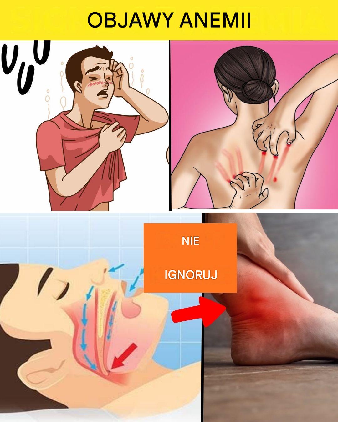 Ciche objawy anemii, których nigdy nie należy ignorować