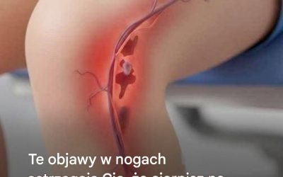 Te objawy w nogach ostrzegają Cię, że tak naprawdę cierpisz na poważną chorobę…Zobacz więcej