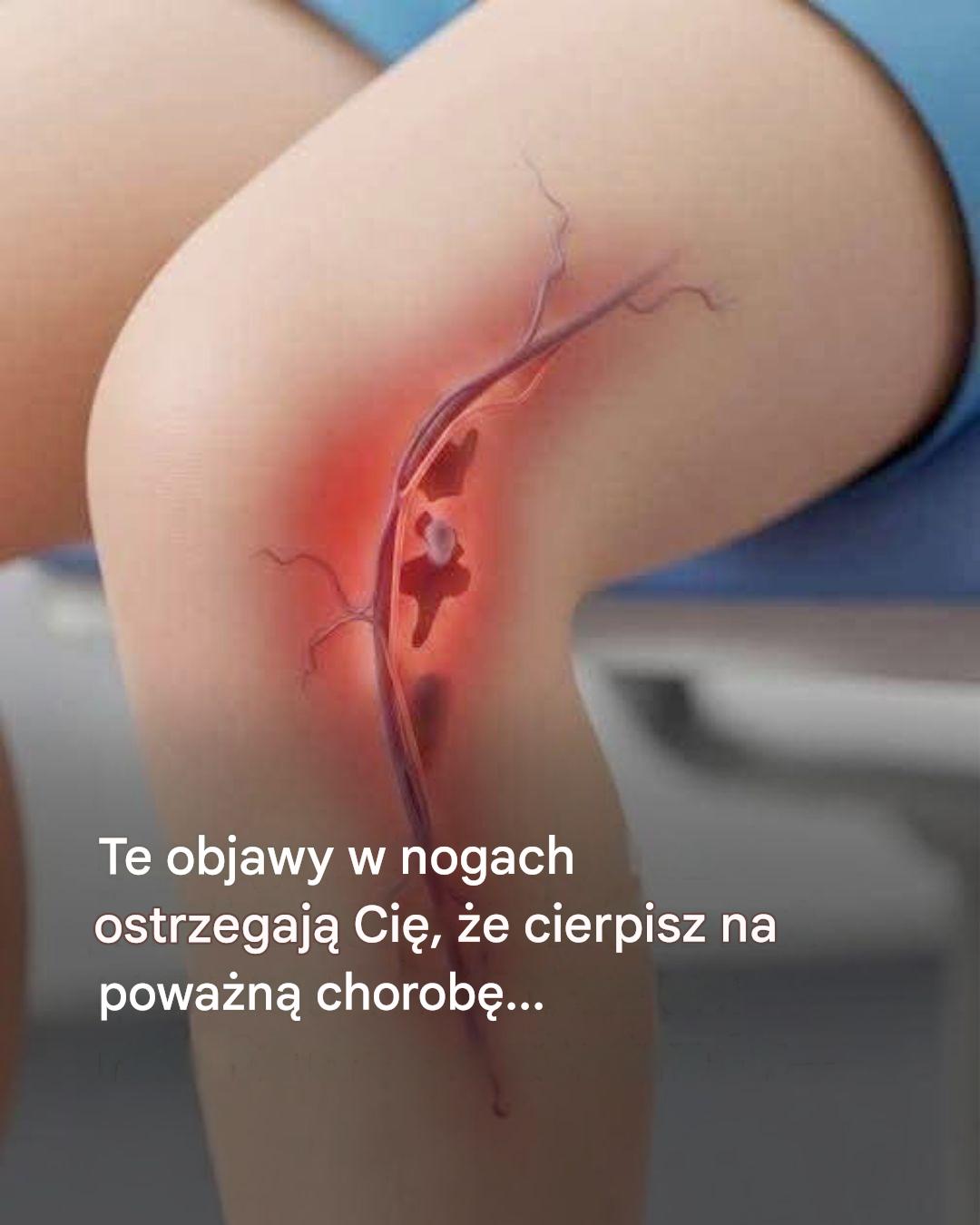 Te objawy w nogach ostrzegają Cię, że tak naprawdę cierpisz na poważną chorobę…Zobacz więcej