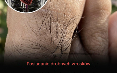 Czy wiesz, że drobne włoski na palcach u rąk i nóg mogą ujawnić pewne informacje na temat Twojego stanu zdrowia?