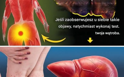 Myślisz, że jesteś zdrowy? Ale Twoja wątroba może się z tym nie zgadzać… Nie ignoruj ​​tych 12 ukrytych sygnałów ostrzegawczych!