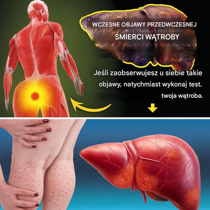 Myślisz, że jesteś zdrowy? Ale Twoja wątroba może się z tym nie zgadzać… Nie ignoruj ​​tych 12 ukrytych sygnałów ostrzegawczych!