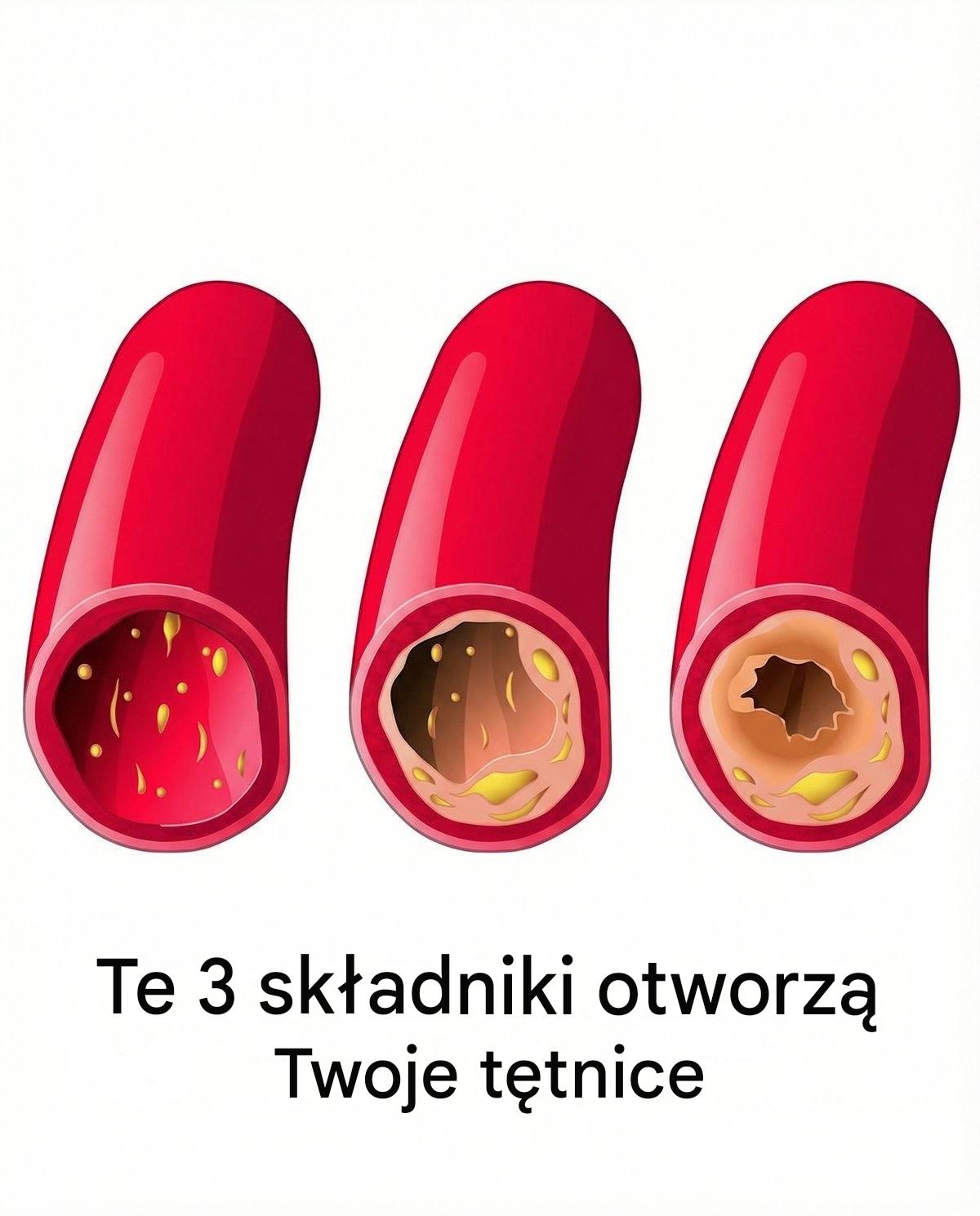 Oczyszczanie tętnic wieńcowych tylko z 3 składnikami