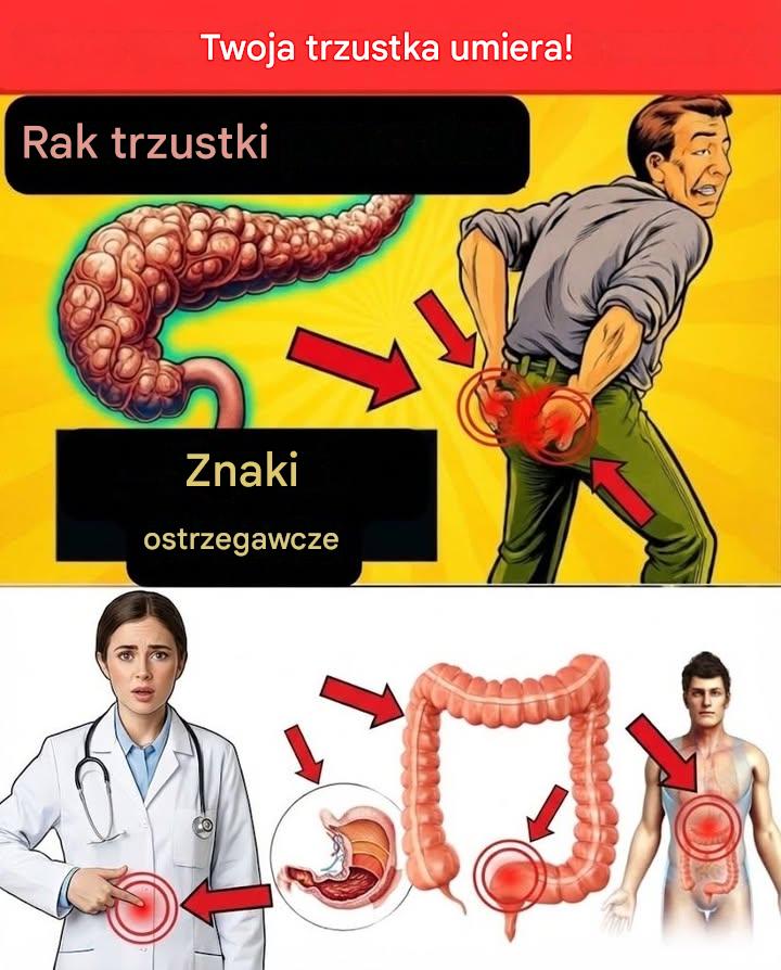 Rak trzustki: 10 objawów, które pomogą Ci go wykryć (nie ignoruj ​​ich)