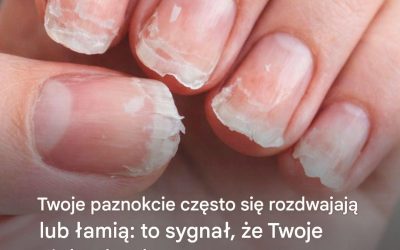 Twoje paznokcie łamią się i rozdwajają: ten szczegół może wskazywać na problem…Zobacz więcej