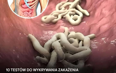 10 oznak, że twoje ciało jest porażone szkodnikami?