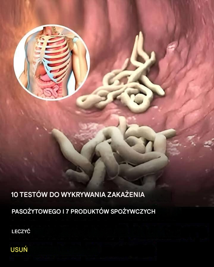 10 oznak, że twoje ciało jest porażone szkodnikami?