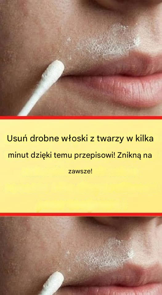 Ta naturalna receptura pozwoli Ci trwale pozbyć się owłosienia na twarzy.