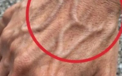 Jeśli żyły na Twojej dłoni są widoczne, jest to znak…