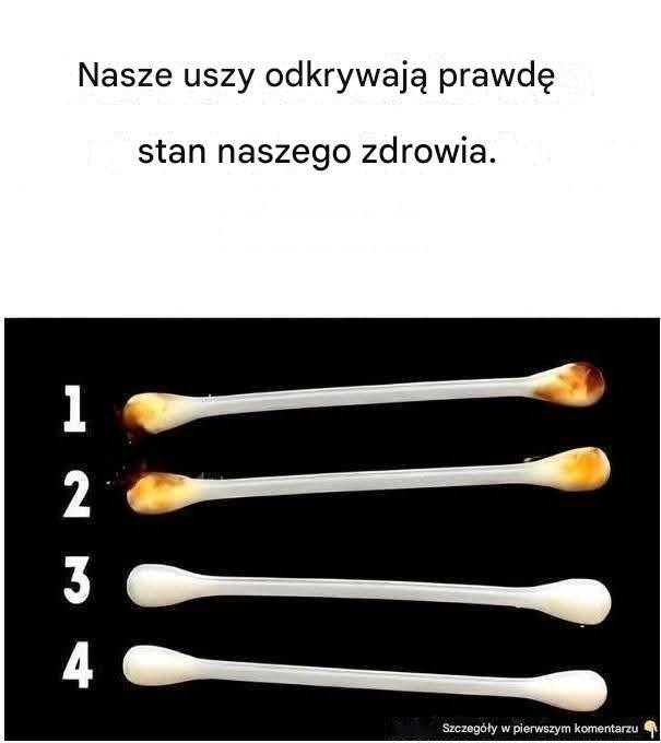 Ludzkie ciało nieustannie nas zadziwia swoimi funkcjami. Jest w stanie wysyłać sygnały, aby ostrzec nas o chorobie lub problemie poprzez różne narządy i obszary. Co więcej, czy wiesz, że nasze uszy mogą wiele powiedzieć o naszym zdrowiu?