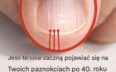Jeśli po 40. roku życia na twoich paznokciach pojawia się linia, może to być znak ostrzegawczy… Zobacz pierwszy komentarz.