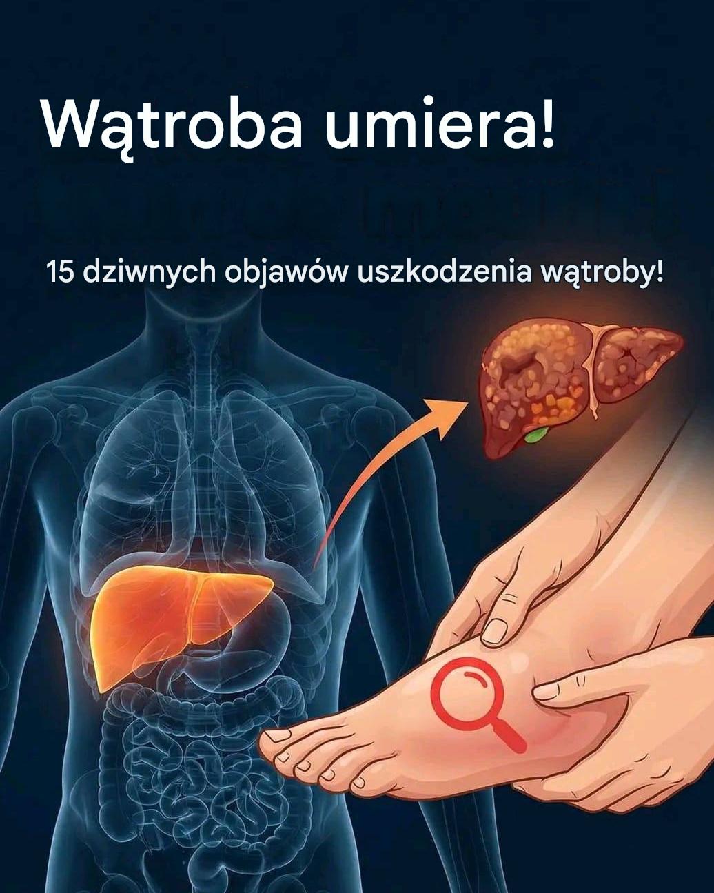 8 sygnałów ostrzegawczych, że Twoja wątroba jest pełna toksyn i powoduje przybieranie na wadze