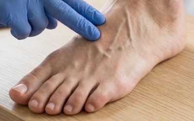 Swędzenie stopóp: kiedy należy zwrócić uwagę na lekarza?