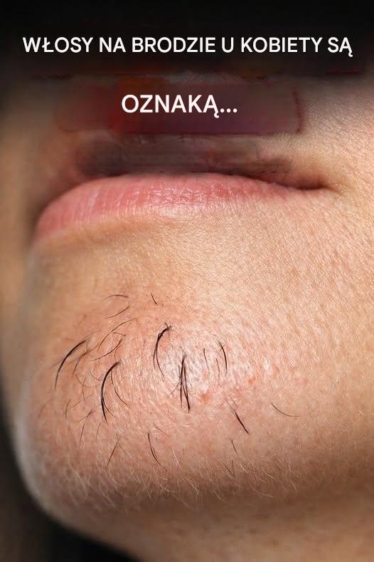 Włosy na brodzie kobiety to znak… Zobacz więcej
