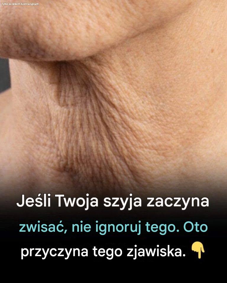 Dlaczego skóra szyi wiotczeje z wiekiem — i co możesz z tym zrobić
