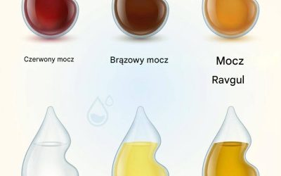 Co kolor moczu mówi o Twoim zdrowiu?