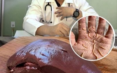 Lekarze ujawniają, że spożywanie wątróbki wołowej może powodować…Zobacz więcej