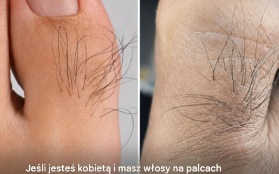 Wiele kobiet nie wie, co zdradzają włoski na palcach u stóp. Dowiedz się więcej.