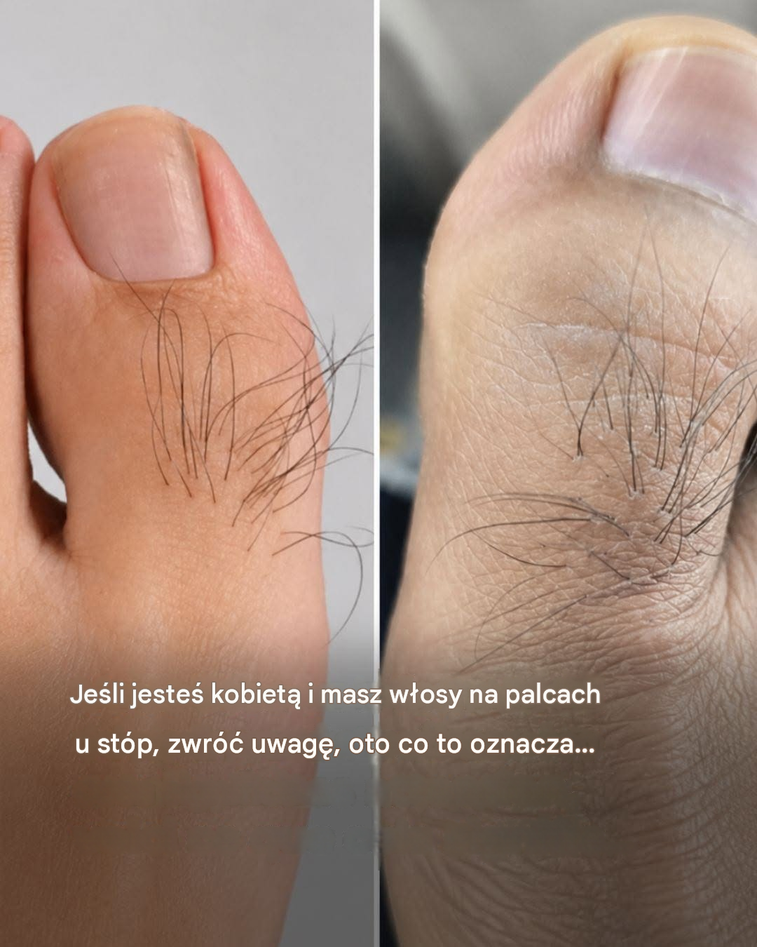 Wiele kobiet nie wie, co zdradzają włoski na palcach u stóp. Dowiedz się więcej.