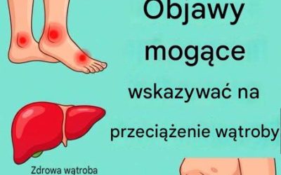 11 oznak, które mogą wskazywać, że Twoja wątroba nie funkcjonuje prawidłowo, a Twój organizm jest przeciążony toksynami.