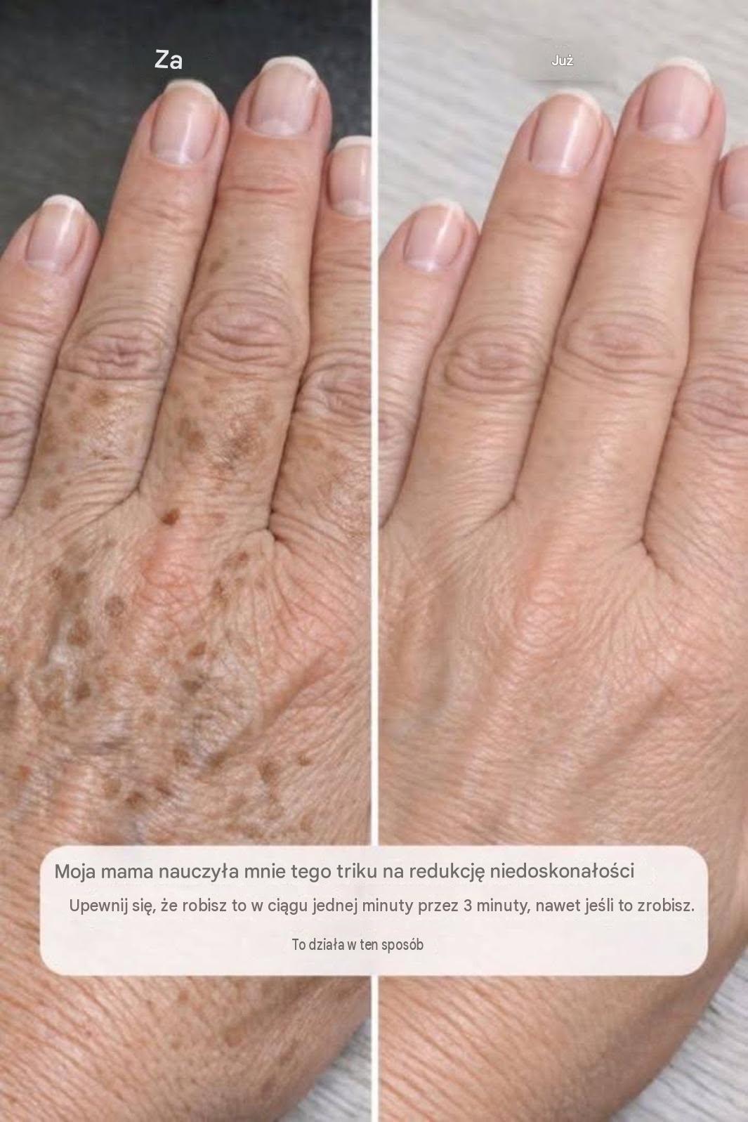 Moja mama nauczyła mnie tego triku, który pozwala zredukować przebarwienia na dłoniach w zaledwie 3 minuty i bez żadnego wysiłku. Oto jak to działa: